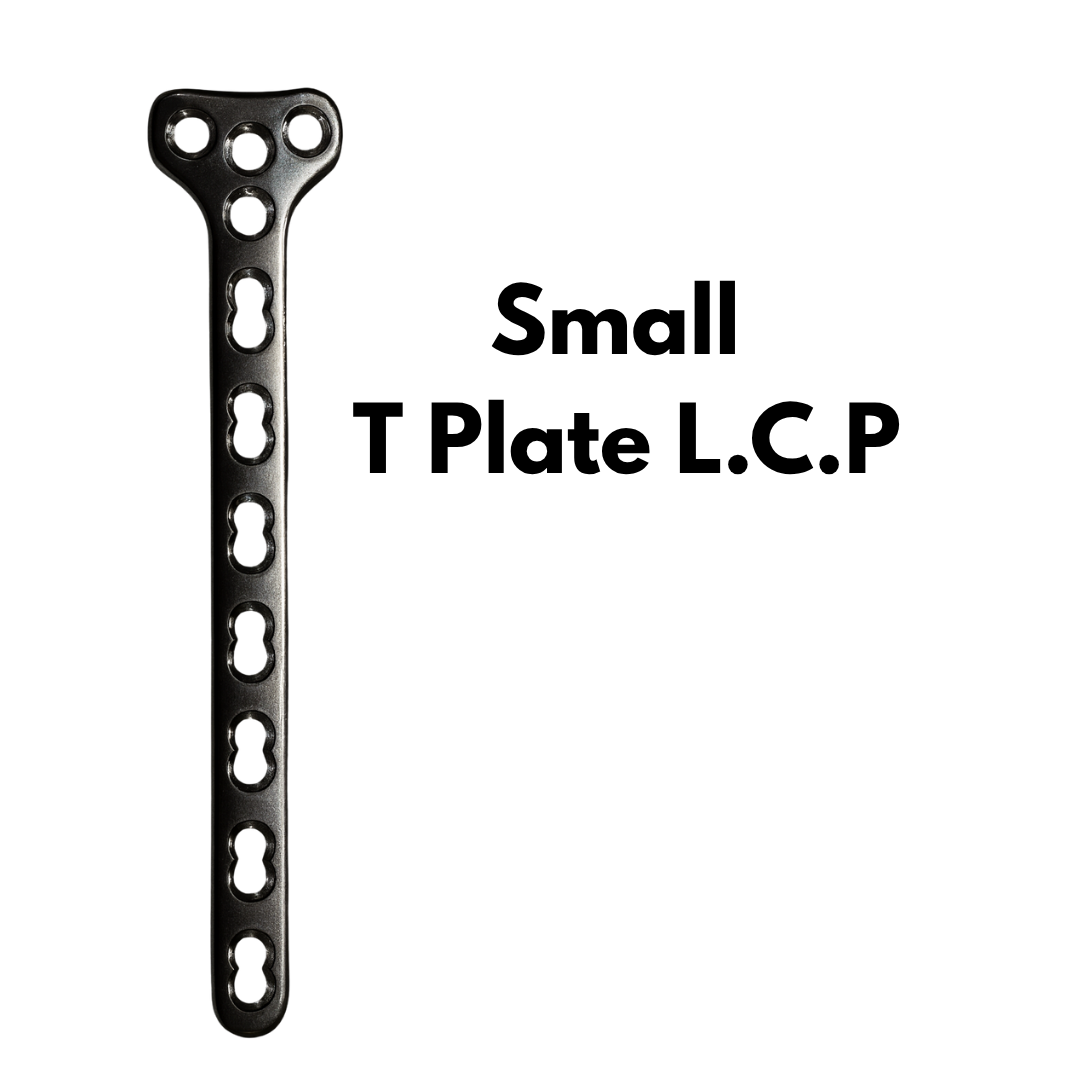 Tibial Lateral Locking Plate (Right / Left)